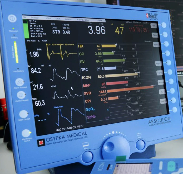 The non-invasive cardiovascular monitor measures stroke volume and blood velocity